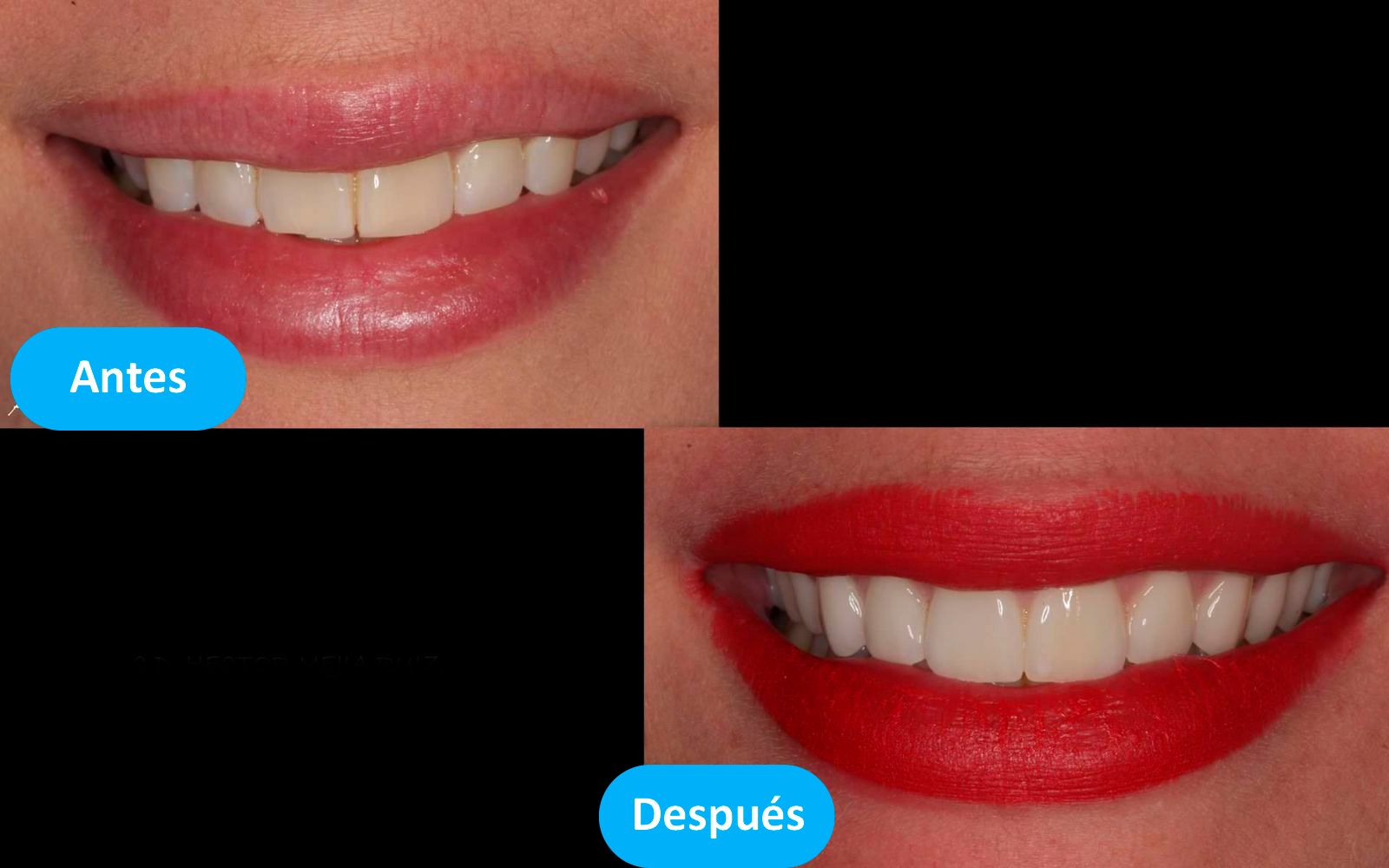 Imagen 4